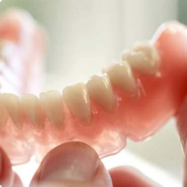 every 5 to 10 years, as the shape of your mouth changes over time. . Aspen dental reviews for dentures
